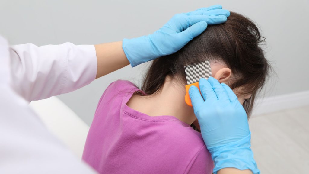 Lice Prevention and Education Tips How Families Can Avoid Head Lice Infestations